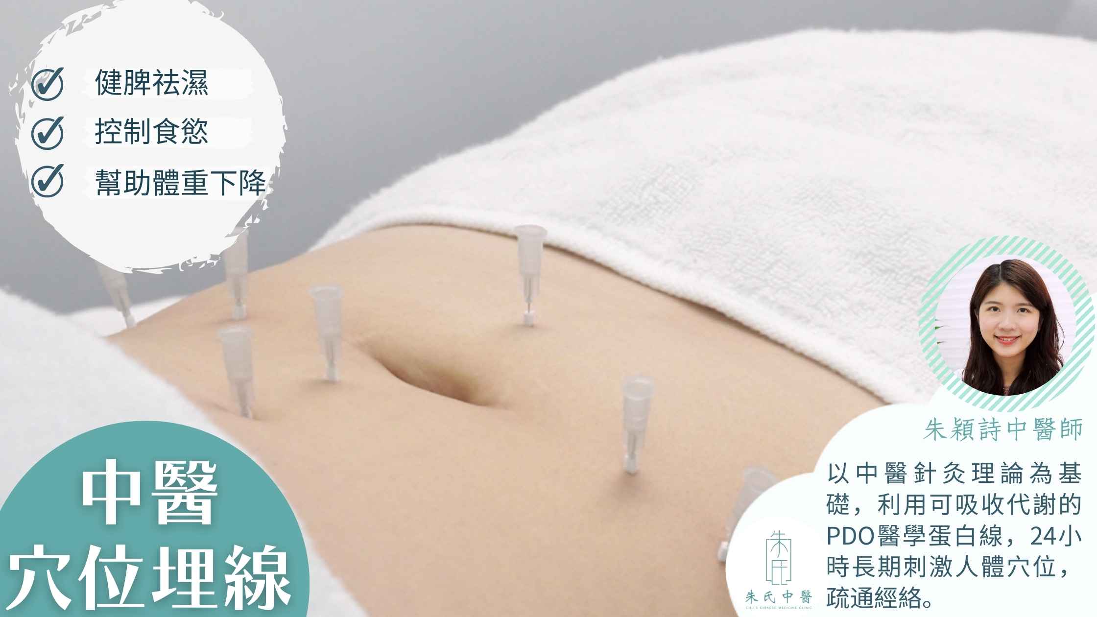 中醫穴位埋線