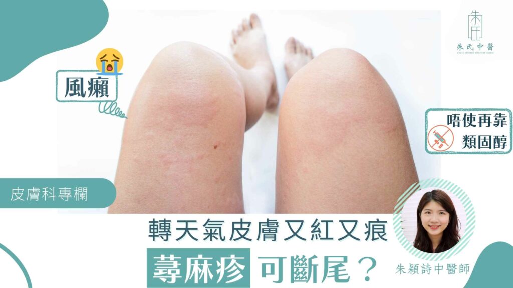 蕁麻疹 _ 風癩