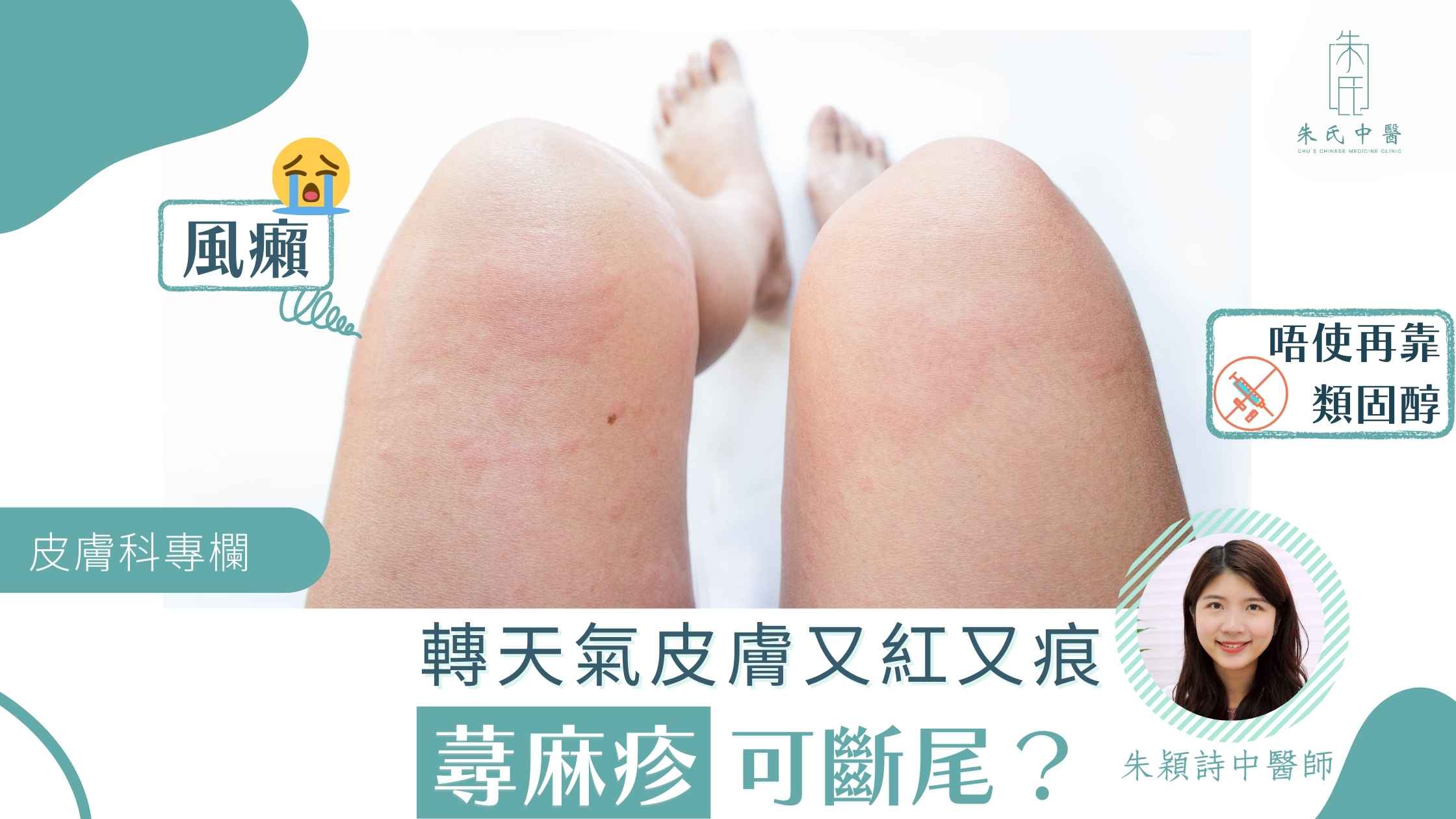 蕁麻疹 _ 風癩
