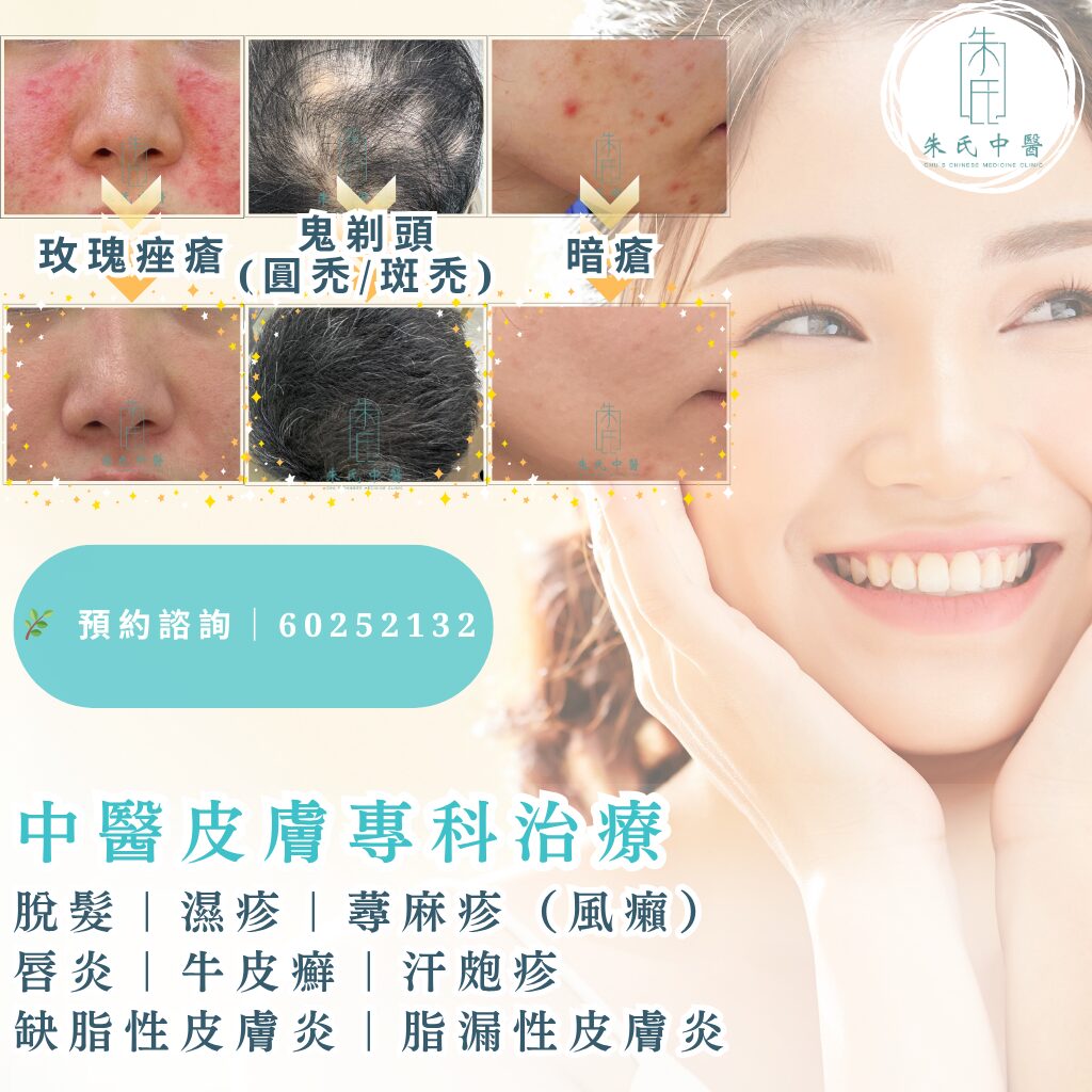 中醫皮膚專科治療