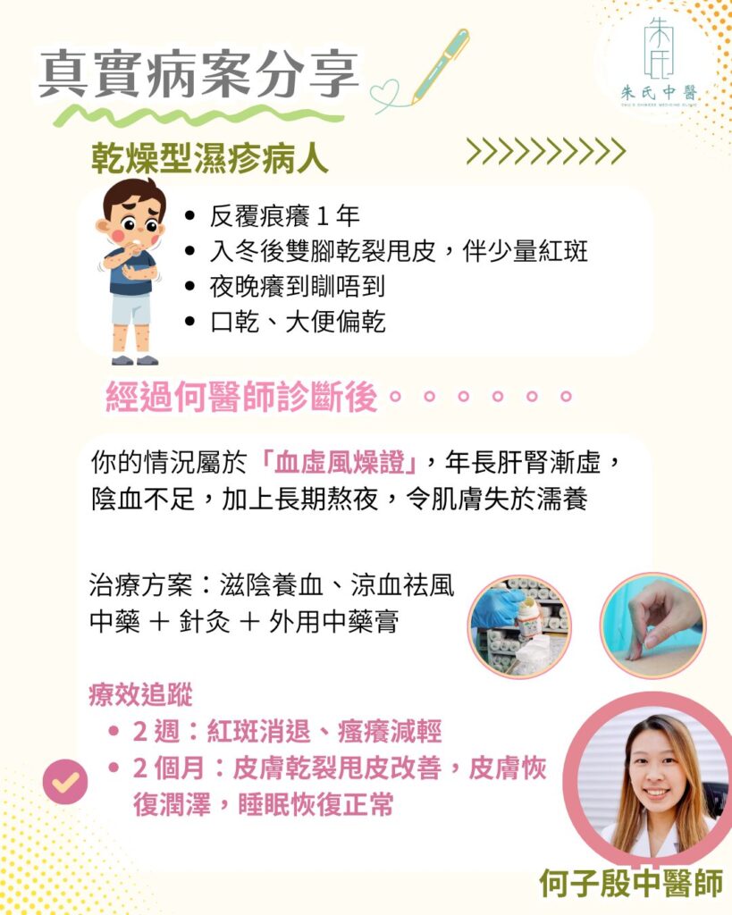 乾燥型濕疹病人